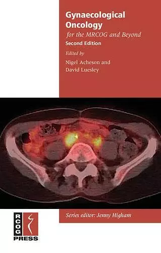 Gynaecological Oncology for the MRCOG and Beyond cover