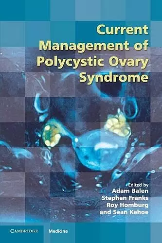 Current Management of Polycystic Ovary Syndrome cover