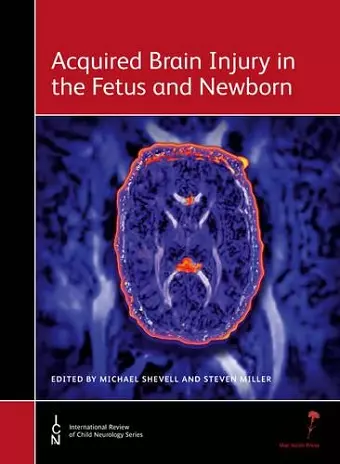 Acquired Brain Injury in the Fetus and Newborn cover