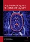 Acquired Brain Injury in the Fetus and Newborn cover