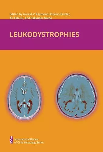 Leukodystrophies cover