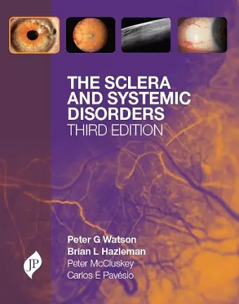 The Sclera and Systemic Disorders cover