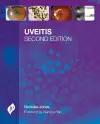 Uveitis cover