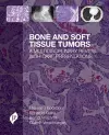 Bone and Soft Tissue Tumors cover