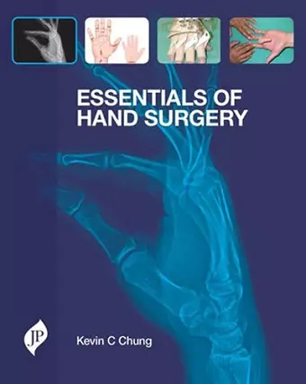 Essentials of Hand Surgery cover