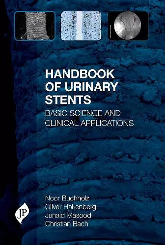 Handbook of Urinary Stents cover