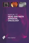 Manual of Head and Neck Surgical Oncology cover