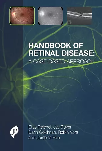Handbook of Retinal Disease: a Case-based Approach cover