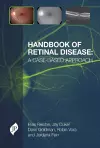 Handbook of Retinal Disease: a Case-based Approach cover