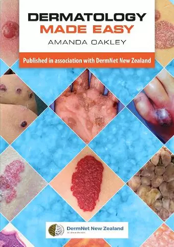 Dermatology Made Easy cover