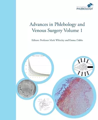 Advances in Phlebology and Venous Surgery - Volume 1 cover