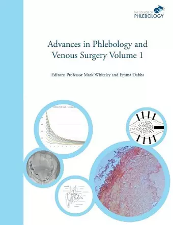 Advances in Phlebology and Venous Surgery cover