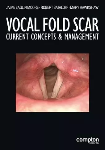 Vocal Fold Scar cover