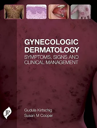 Gynecologic Dermatology cover