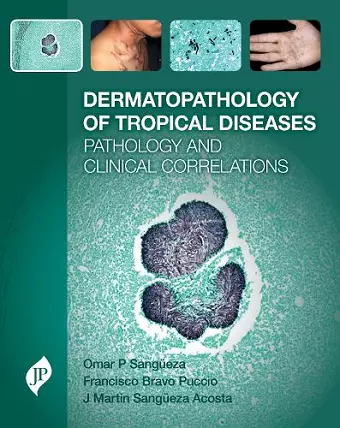 Dermatopathology of Tropical Diseases cover