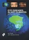 Eye Diseases in Hot Climates cover