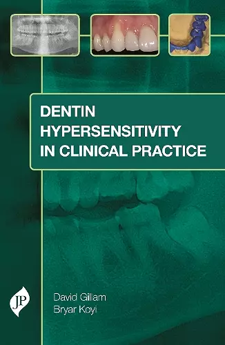 Dentin Hypersensitivity in Clinical Practice cover