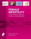 Female Infertility cover