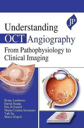 Understanding OCT Angiography cover