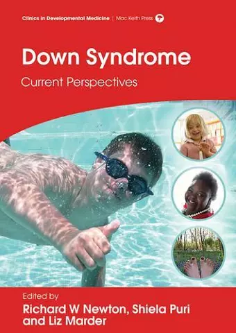 Down Syndrome cover