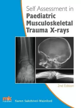 Self-Assessment in Paediatric Musculoskeletal Trauma X-Rays cover