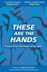 These Are The Hands cover