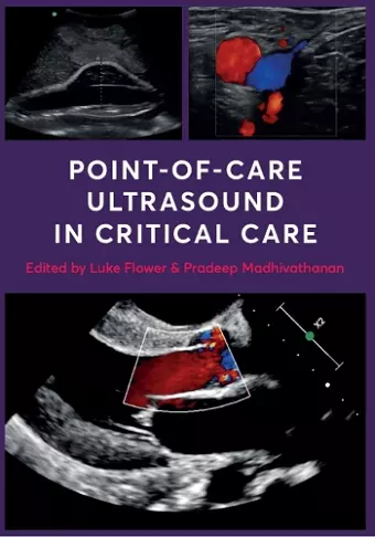Point-of-Care Ultrasound in Critical Care cover