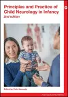 Principles and Practice of Child Neurology in Infancy cover