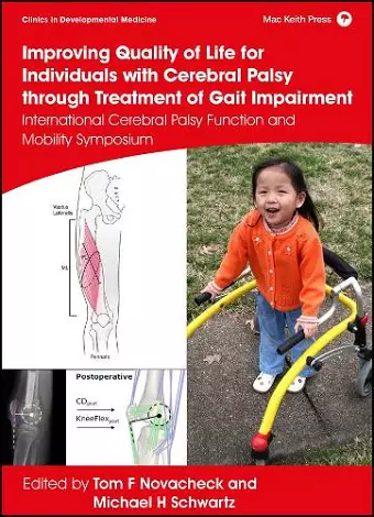 Improving Quality of Life for Individuals with Cerebral Palsy through Treatment of Gait Impairment cover