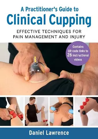 A Practitioner's Guide to Clinical Cupping cover