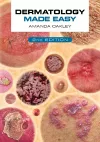 Dermatology Made Easy, second edition cover