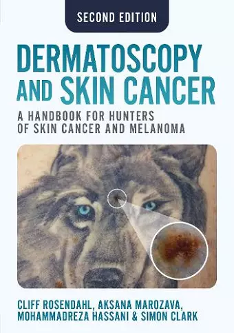 Dermatoscopy and Skin Cancer, second edition cover