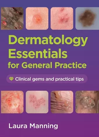 Dermatology Essentials for General Practice cover