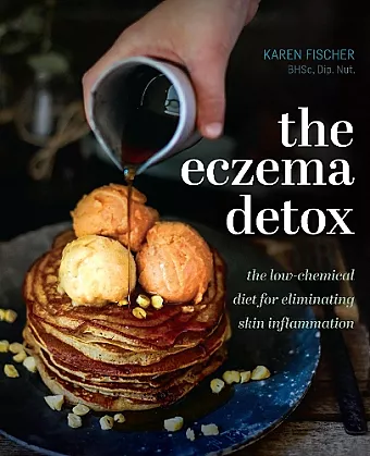 The Eczema Detox cover