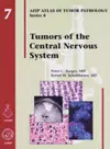 Tumors of the Central Nervous System cover