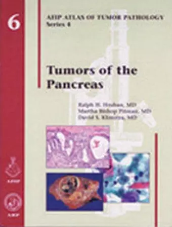 Tumors of the Pancreas cover