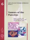 Tumors of the Pancreas cover