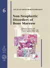 Non-Neoplastic Diseases of Bone Marrow cover