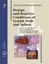 Benign and Reactive Conditions of Lymph Node and Spleen cover