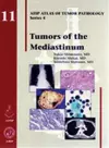 Tumors of the Mediastinum cover