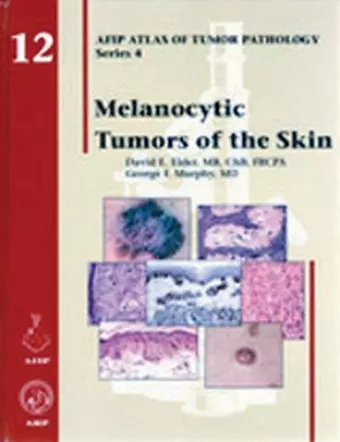 Melanocytic Tumors of the Skin cover