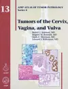 Tumors of the Cervix, Vagina, and Vulva cover