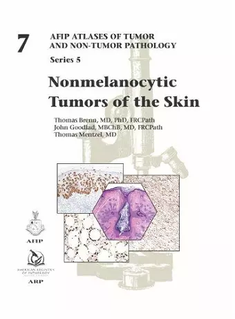 Nonmelanocytic Tumors of the Skin cover