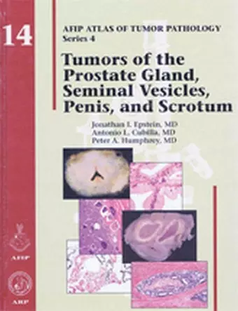 Tumors of the Prostate Gland, Seminal Vesicles, Penis, and Scrotum cover