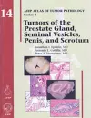 Tumors of the Prostate Gland, Seminal Vesicles, Penis, and Scrotum cover