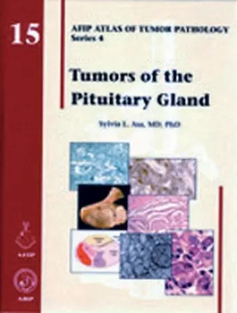 Tumors of the Pituitary Gland cover