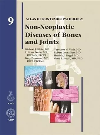 Non-Neoplastic Diseases of Bones and Joints cover