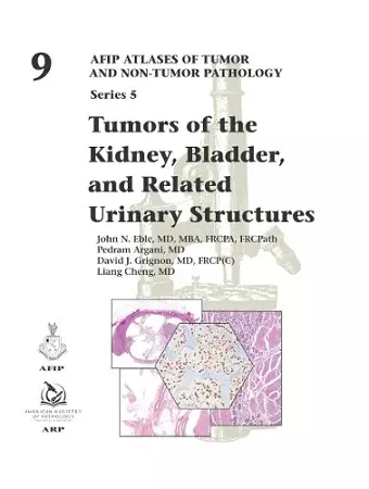 Tumors of the Kidney, Bladder, and Related Urinary Structures cover