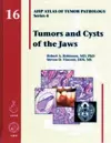 Tumors and Cysts of the Jaws cover