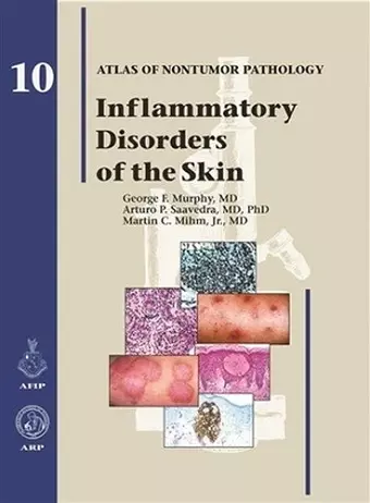 Inflammatory Disorders of the Skin cover